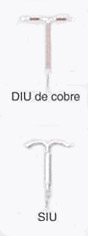 DIU de cobre / SIU