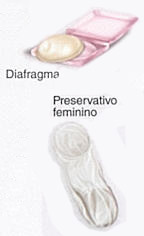Preservativo feminino/ Diafragma